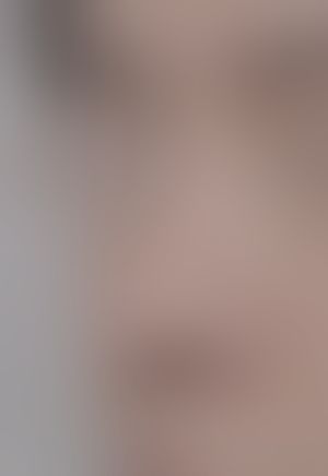 다시 살아나게 만드는 수술 수술 전